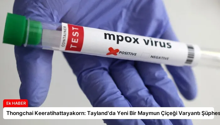 Thongchai Keeratihattayakorn: Tayland’da Yeni Bir Maymun Çiçeği Varyantı Şüphesi