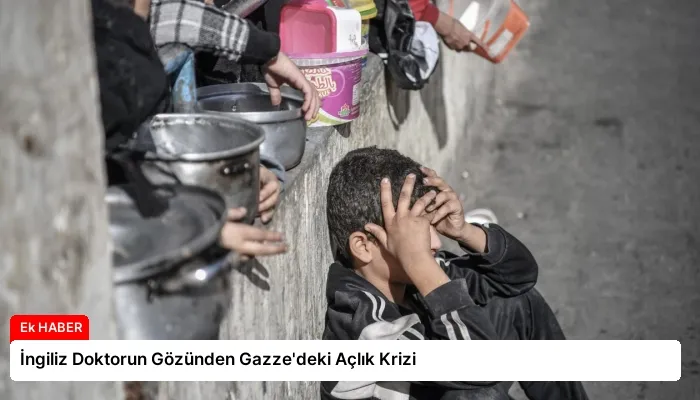 İngiliz Doktorun Gözünden Gazze’deki Açlık Krizi