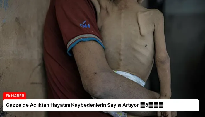 Gazze’de Açlıktan Hayatını Kaybedenlerin Sayısı Artıyor ⏬👇