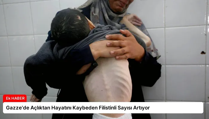 Gazze’de Açlıktan Hayatını Kaybeden Filistinli Sayısı Artıyor